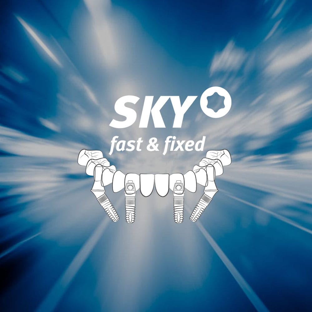 SKY fast & fixed - The success formula in the practice | bredent group ...