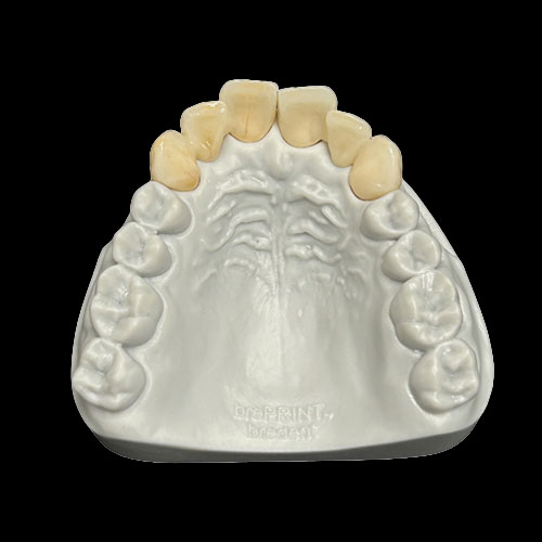 Course result from occlusal view
